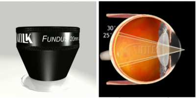 Fundus 20[VFUNDUS20]